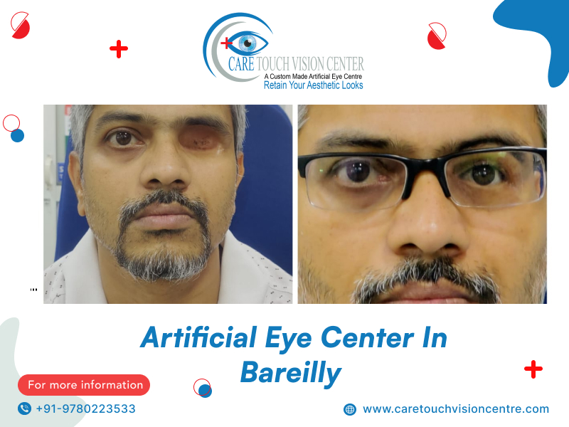 Artificial Eye Centre In bareilly