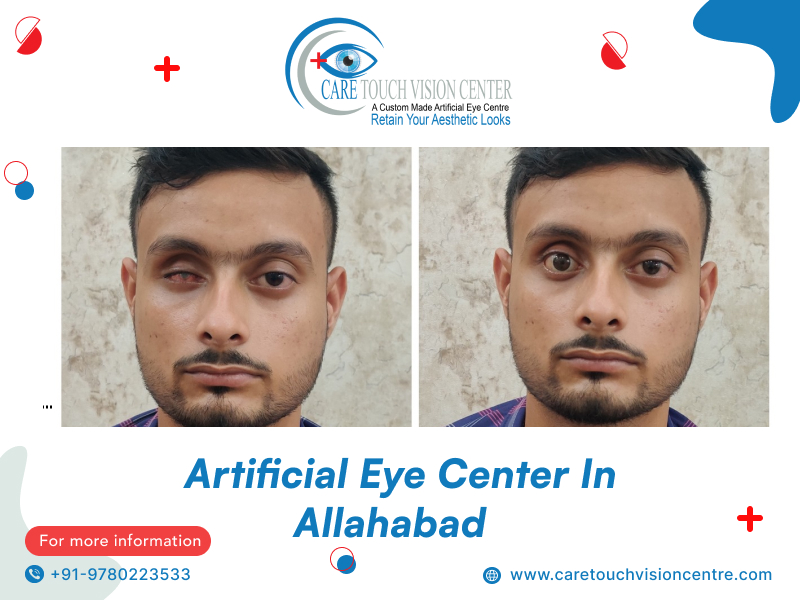 artificial eye centre allahabad