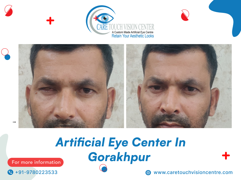 artificial eye centre gorakhpur