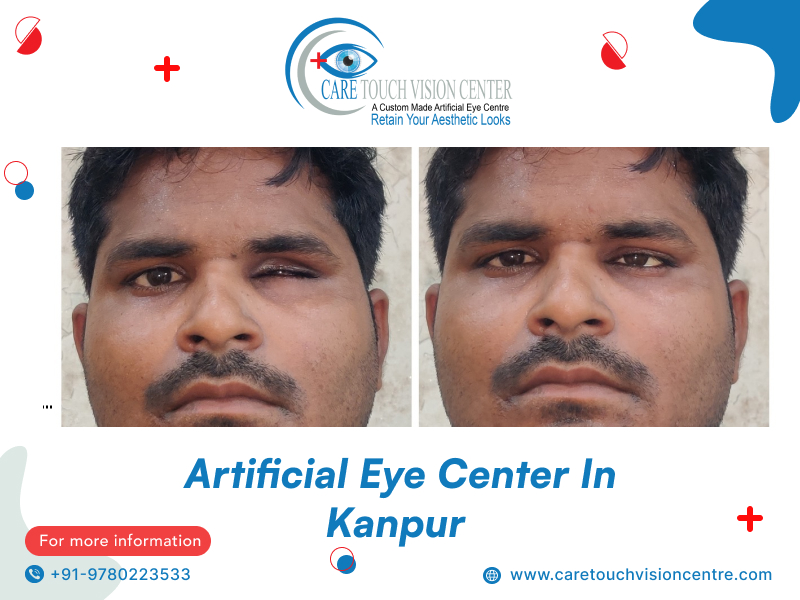 artificial eye centre in kanpur