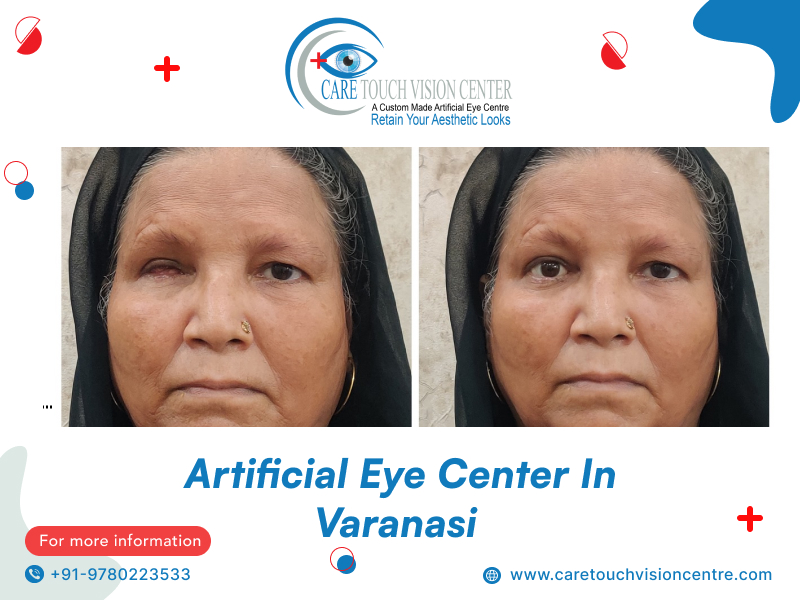 artificial eye centre in varanasi